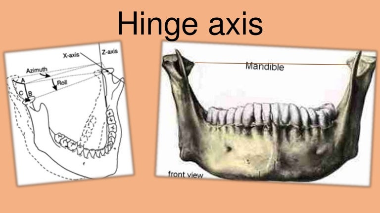What is hinge